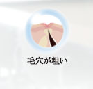 毛穴が粗い